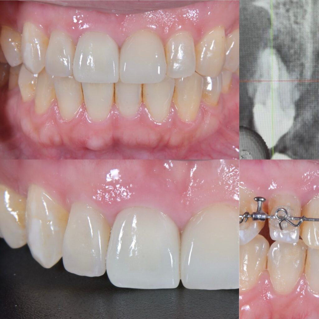 宇部市矯正歯科