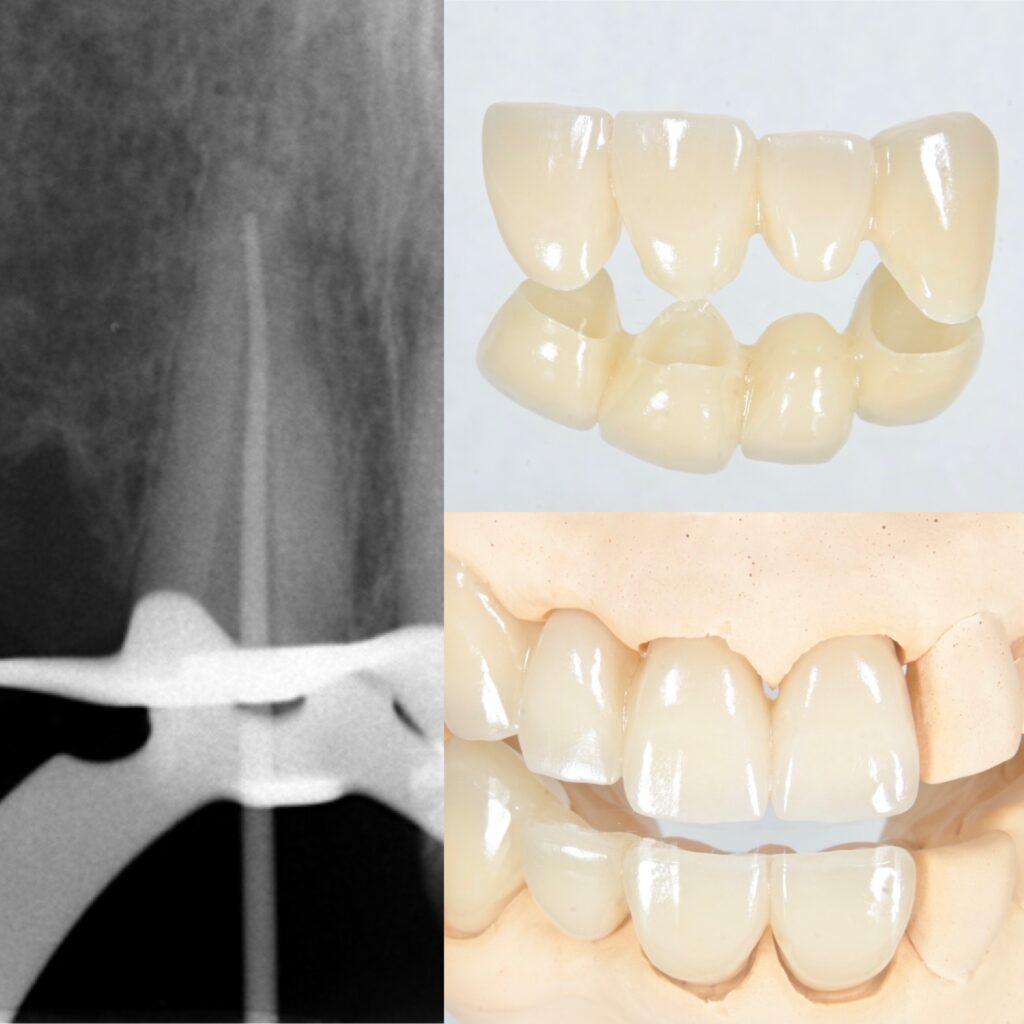 宇部市セラミック