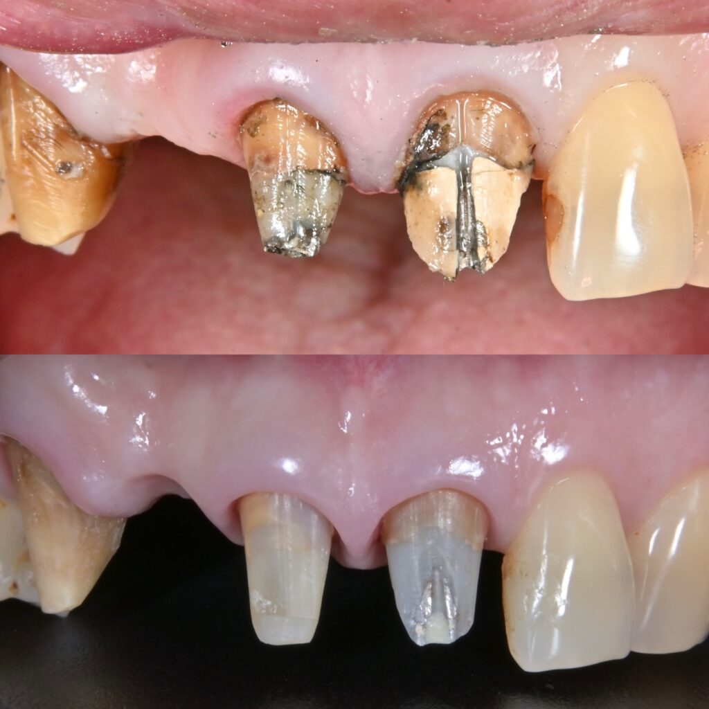 宇部市セラミック